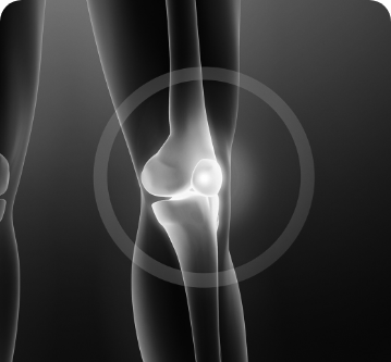 Knie